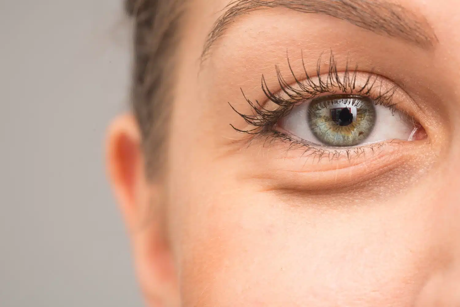 Blépharoplastie inférieure | Centre Esthétique Trémoille | Paris