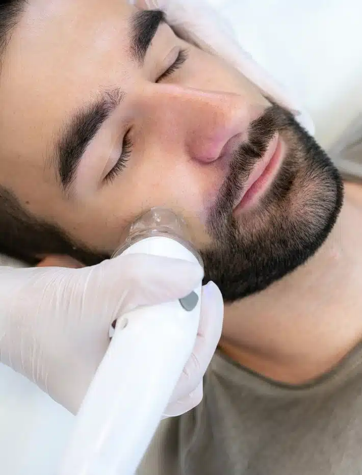 Un Homme profitant d'un raffermissement naturel de la peau avec la radiofrequence au centre esthetique et laser tremoille a paris 8