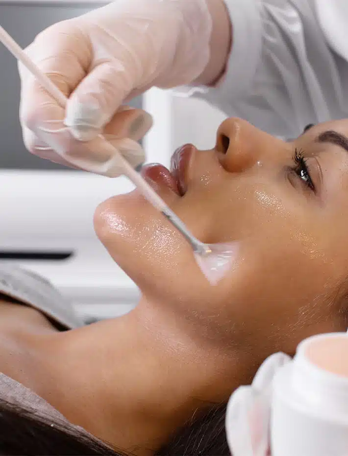 Peeling pour peau mattes et foncées au centre esthetique et laser Tremoille de paris 8