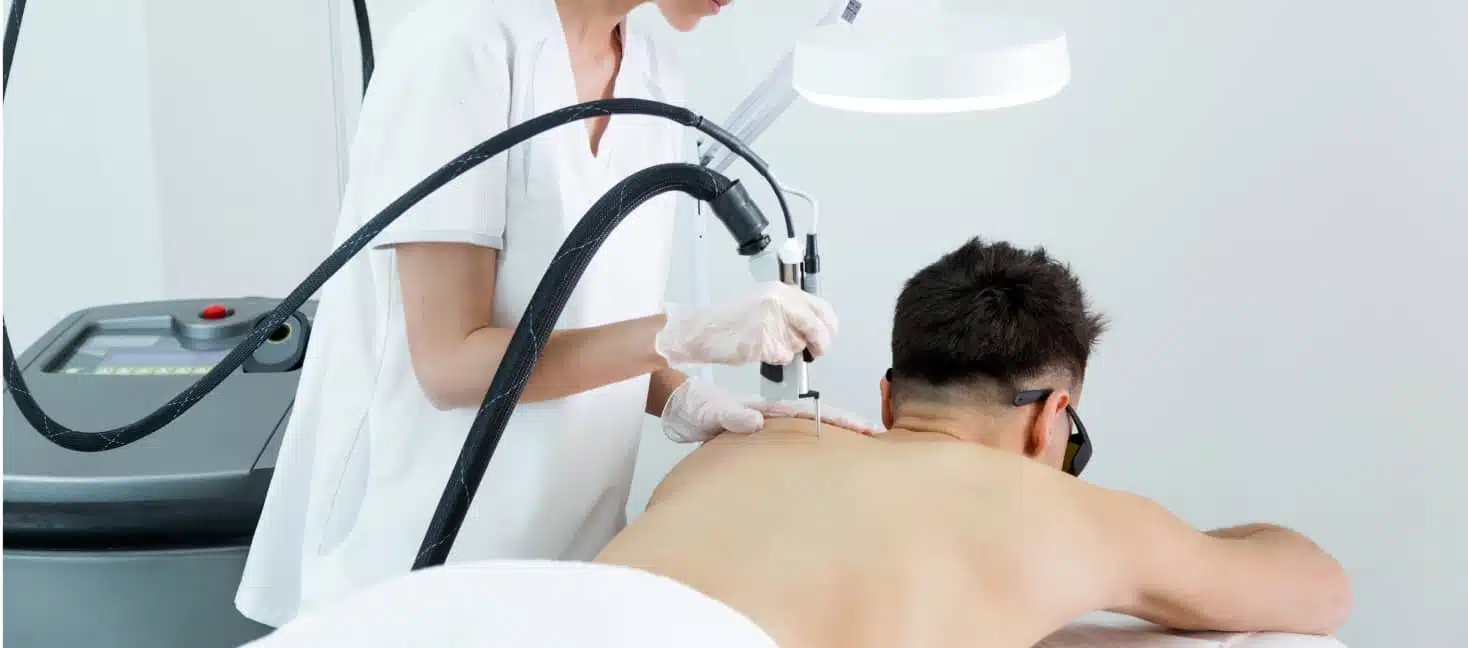 L’épilation au laser chez l’homme : la même efficacité que chez les femmes ? | Centre Esthétique Trémoille | Paris