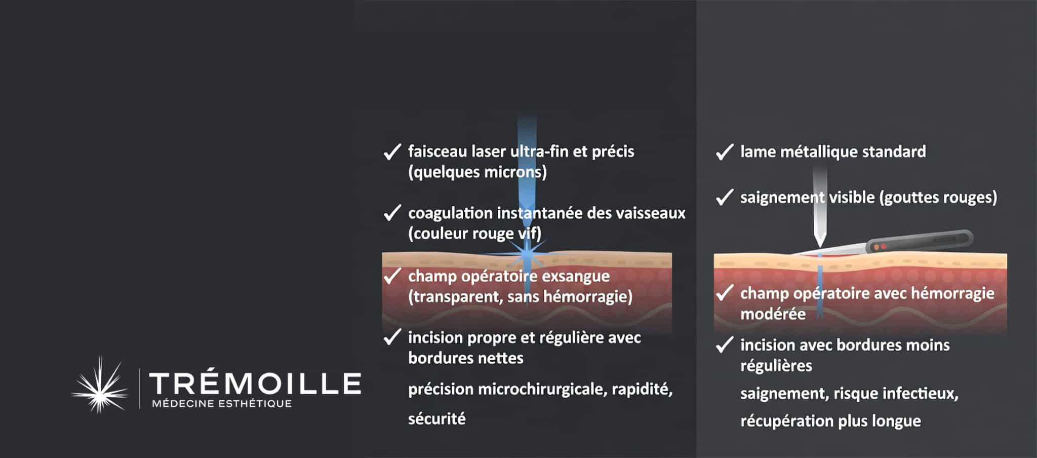 Comparaison bistouri laser CO2 versus bistouri classique en chirurgie