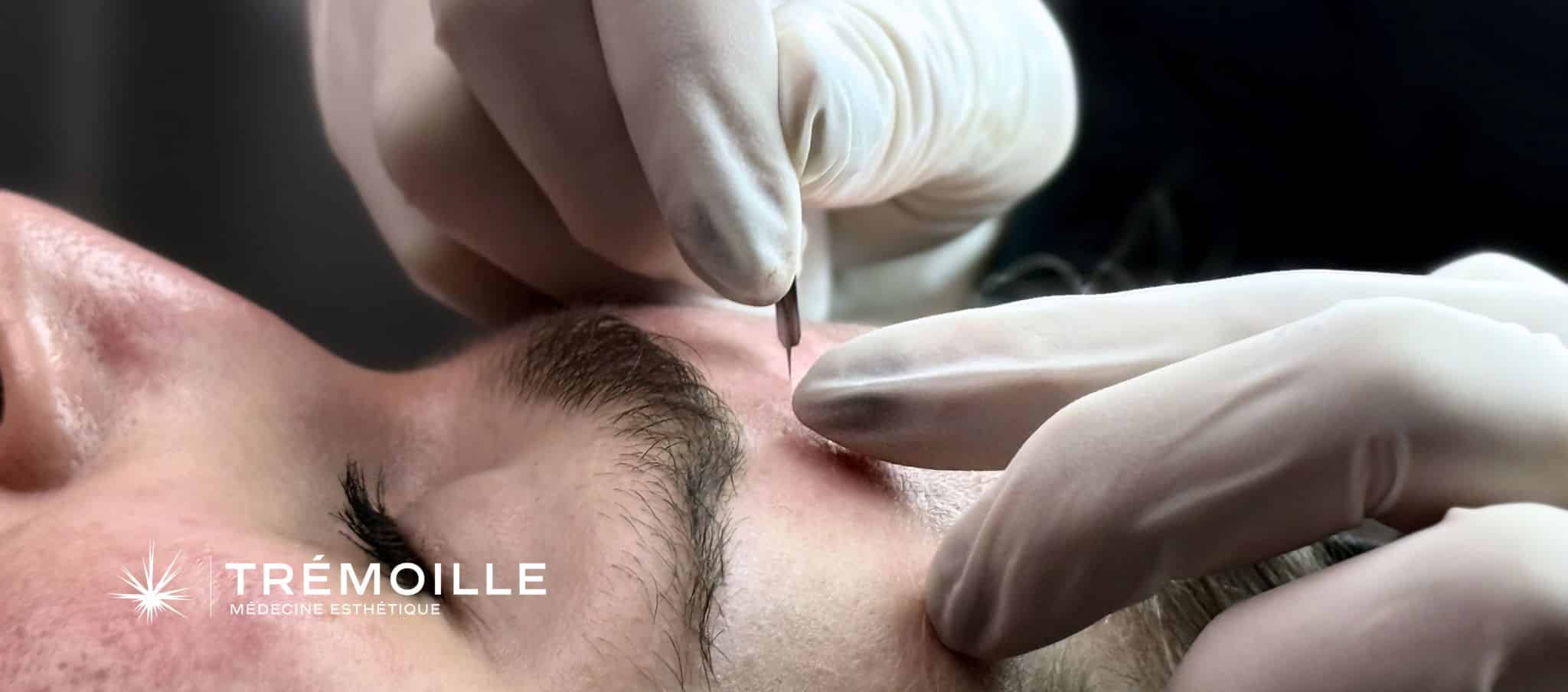 grain de milium enlever Paris