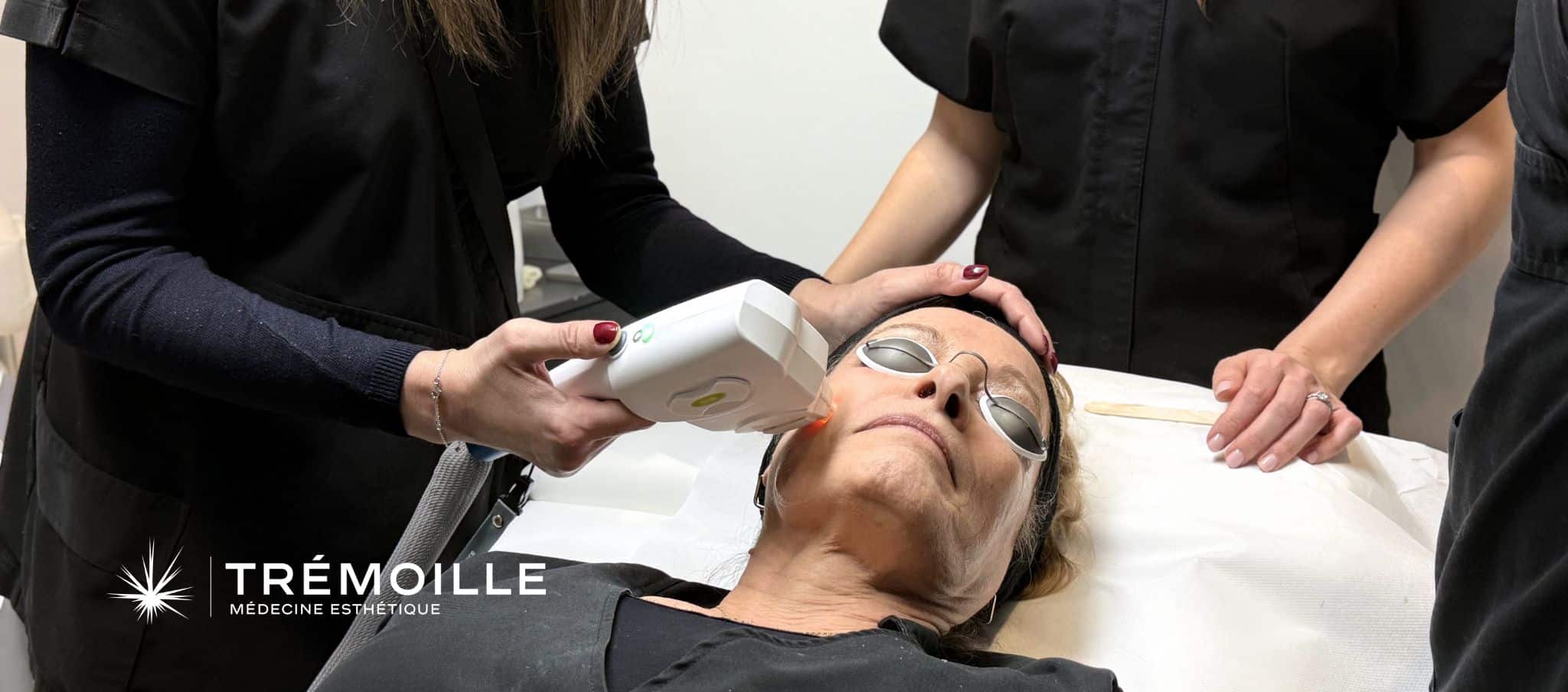 laser taches brunes visage, laser rougeurs couperose, laser fractionné visage Paris, traitement laser peau, laser sans éviction sociale, laser Etherea Paris, photorajeunissement laser