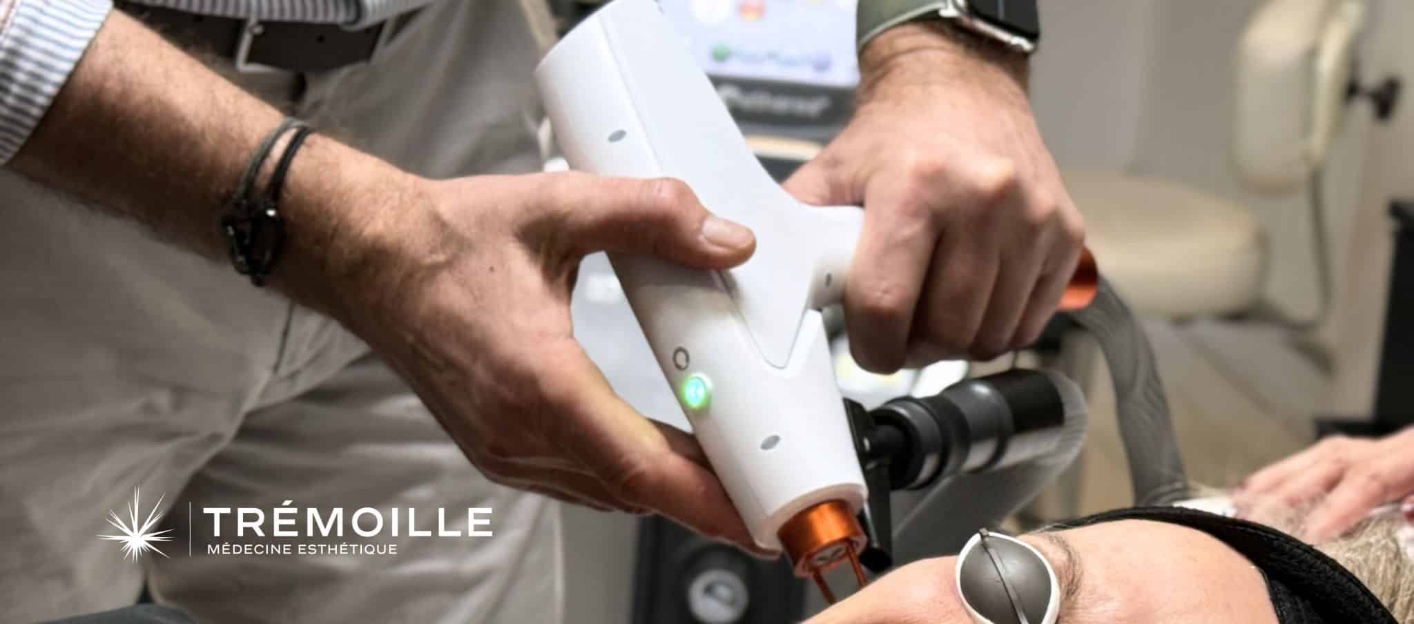quel laser pour le visage centre esthétique à paris