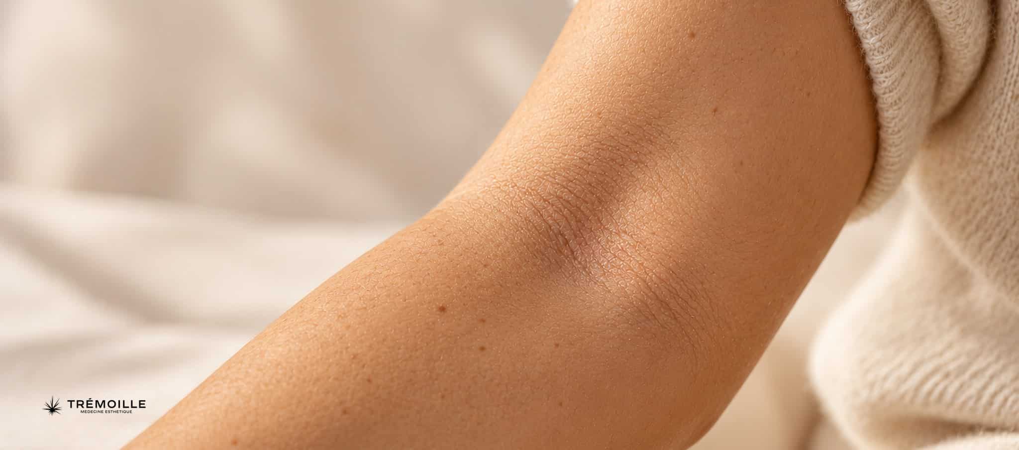 Pli du coude et avant-bras, peau légèrement sèche en lumière douce
